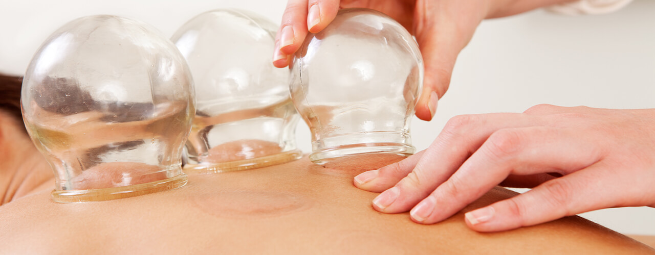 Cupping Therapy Spartanburg & Greer, SC
